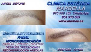 Micropigmentación de cejas en Marbella CLINICA ESTÉTICA MARBELLA - Los más avanzados tratamientos de maquillaje permanente