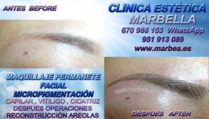Micropigmentación de cejas en Marbella CLINICA ESTÉTICA MARBELLA - Los más avanzados tratamientos de maquillaje permanente