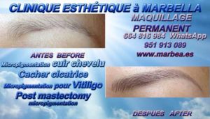 MAQUILLAGE PERMANENT MARBELLA Soyez bienvenus dans la Clinique de la Médecine Esthétique, de la MICRO PIGMENTATION DES CHEVEUX