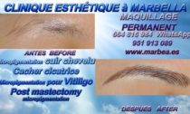 TATOUAGE SOURCILS MARBELLA Soyez bienvenus dans la Clinique de la Médecine Esthétique, de la MICRO PIGMENTATION DES CHEVEUX