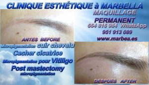 MAQUILLAGE PERMAMENT MARBELLA Soyez bienvenus dans la Clinique de la Médecine Esthétique, de la MICRO PIGMENTATION DES CHEVEUX